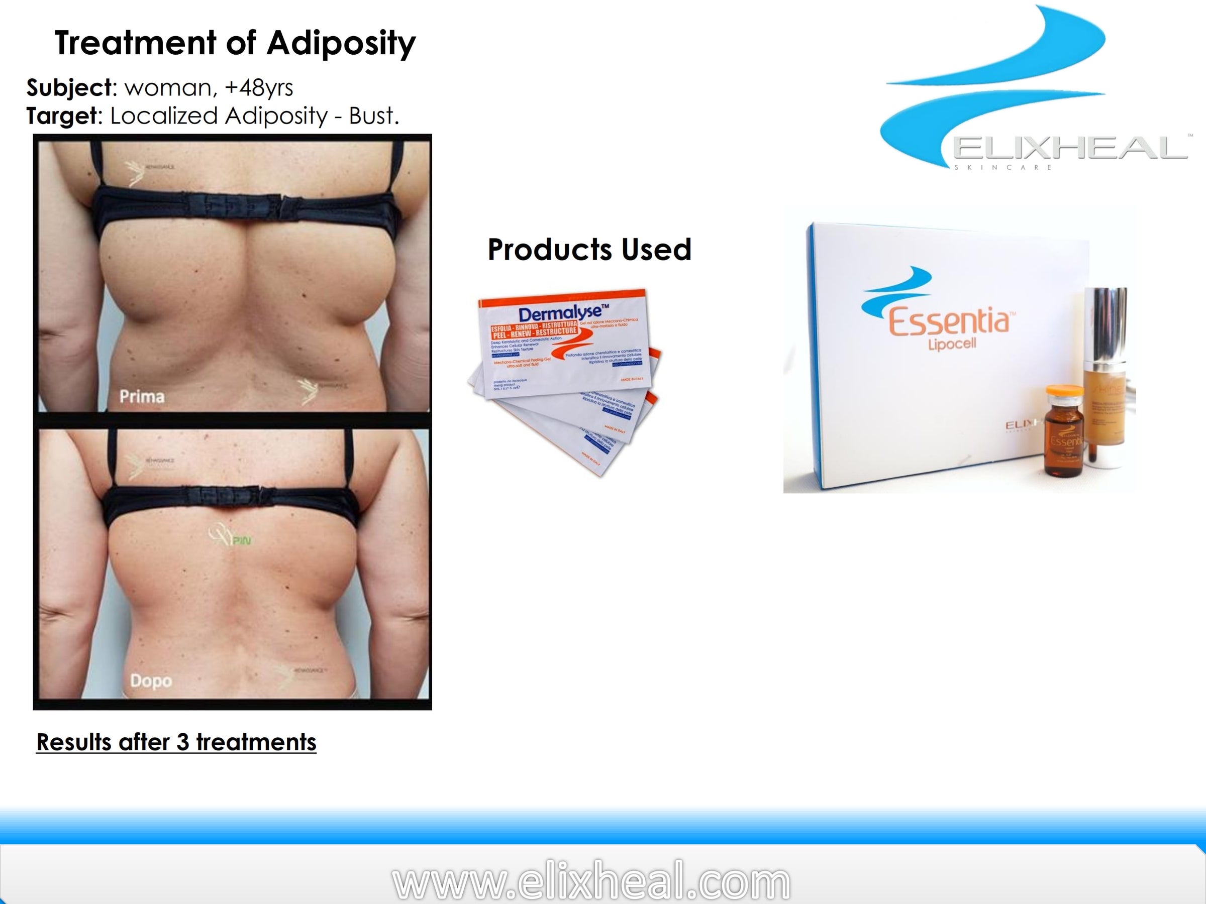xcel lipo c 3-Mac Lipo : C-MED MEDICAL main image 0